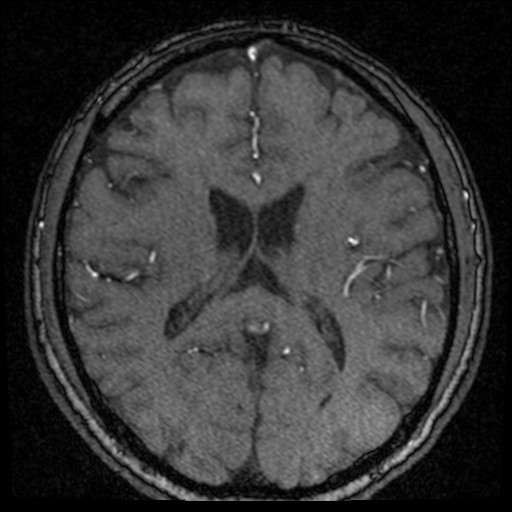 Click on the Serie image to view the images of VILLANUEVA, WILLIAM A.